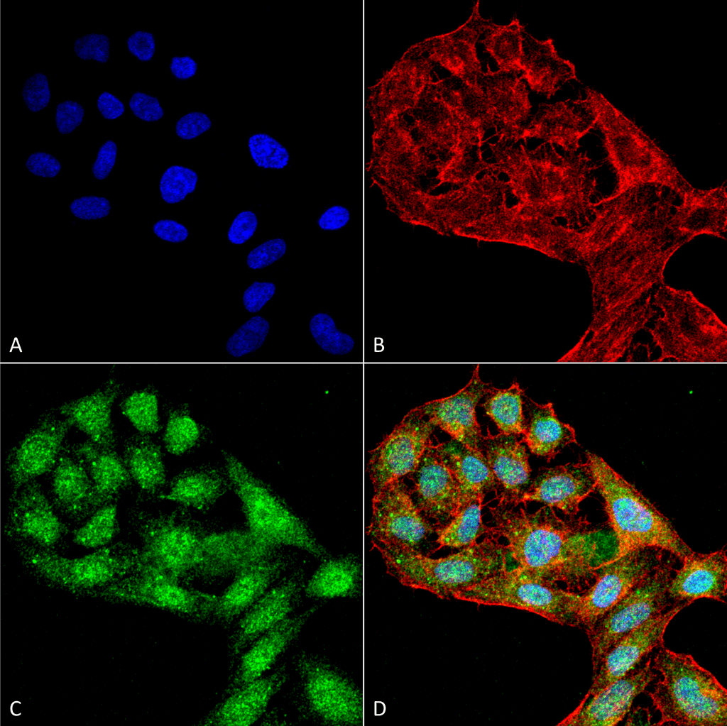 Polyclonal Rabbit anti-Human WIPI2 Antibody (IHC, IF, WB)