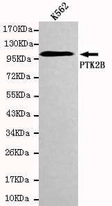 Monoclonal Mouse anti-Human PTK2B / PYK2 Antibody (WB)