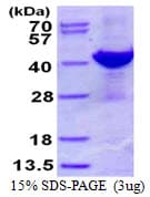 Human ADPRH / ARH1 Protein (Recombinant His)