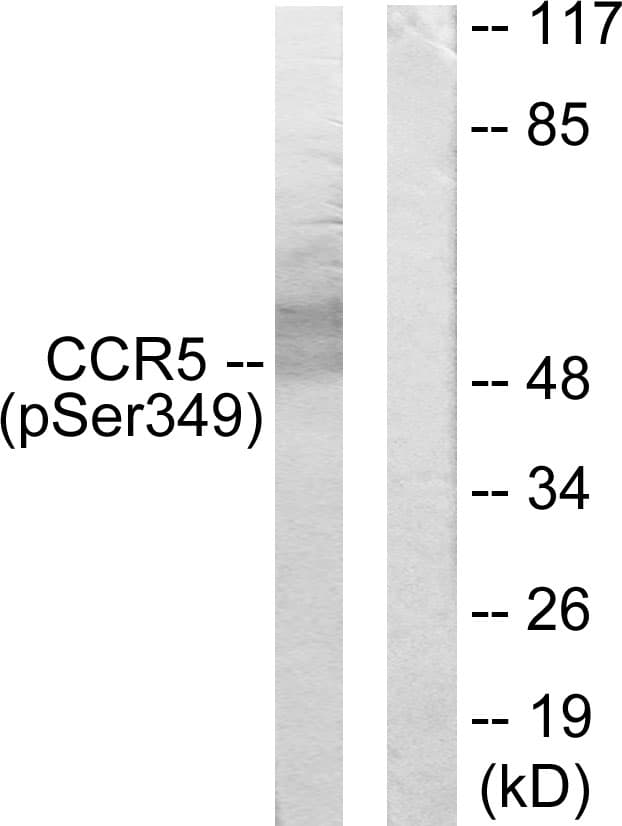 CCR5 Antibody (phospho-Ser349)