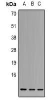 Polyclonal Rabbit anti-Human CSTA / Cystatin A Antibody (Internal, IHC, IF, WB)