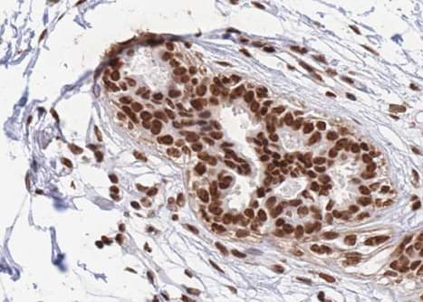 Polyclonal Rabbit anti-Human RBMX Antibody (IHC, IF, WB)