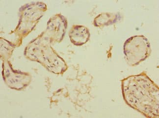 KYNU Antibody