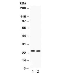 LCN2 / Lipocalin 2 / NGAL Antibody