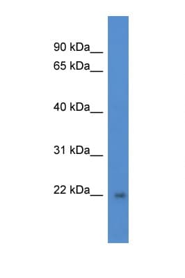 DGCR6L Antibody (aa119-168)