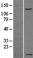 ITGA5/Integrin Alpha 5/CD49e Protein (Over-Expression Lysate Myc-DDK (Flag))