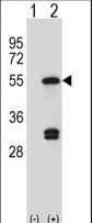 Polyclonal Rabbit anti-Human FDFT1 / Squalene Synthase Antibody (aa332-361, WB)