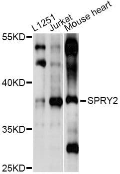 SPRY2 / Sprouty 2 Antibody