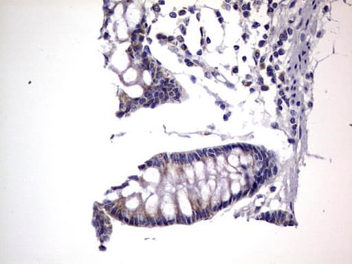 PRX-1 / PRRX1 Antibody (clone OTI1E10)