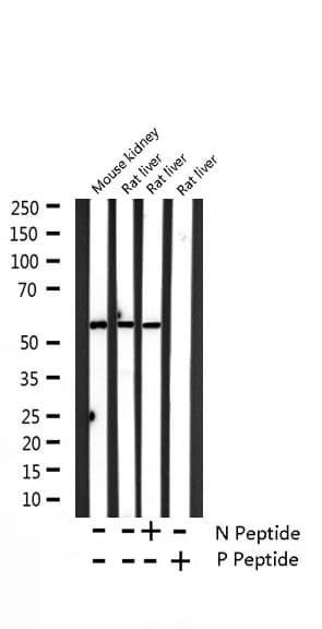 CASP8 / Caspase 8 Antibody (phospho-Ser347)
