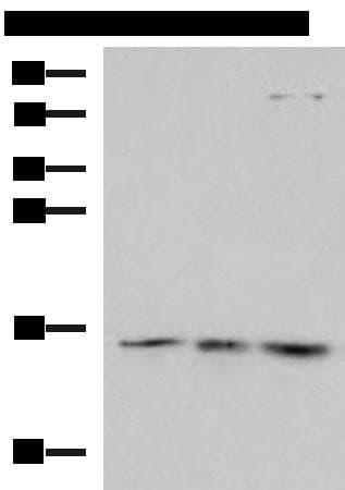 Polyclonal Rabbit anti-Human H2AFJ Antibody (IHC, WB)