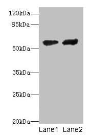 CYP17 / CYP17A1 Antibody (aa24-508)