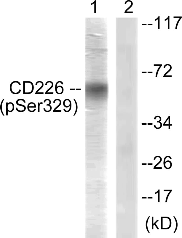 Polyclonal Rabbit anti-Human DNAM-1 / CD226 Antibody (phospho-Ser329, IHC, IF, WB)