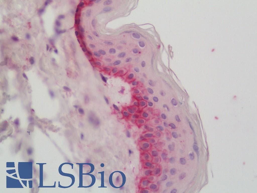 IHC-plus™ COL17A1 / Collagen XVII Antibody