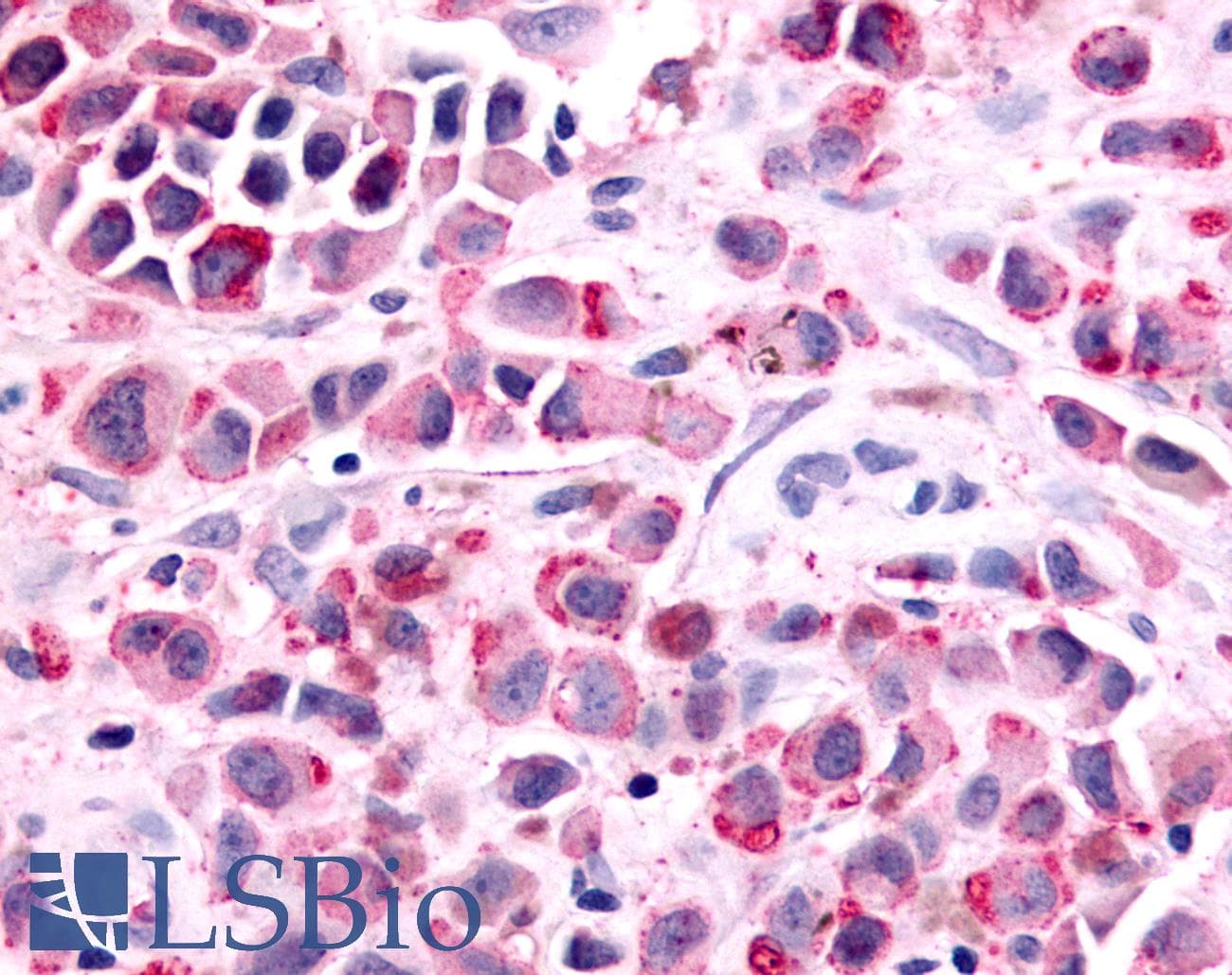 PathPlus™ PTGER1 / EP1 Antibody (Cytoplasmic Domain)