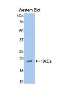 HK1 / Hexokinase 1 Antibody (aa530-675, Cy3)