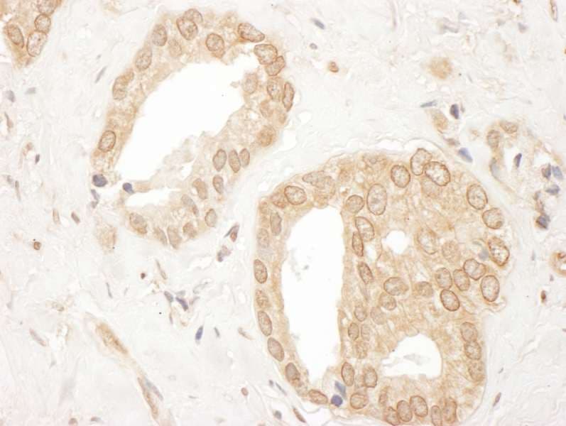 UBR4 Antibody (aa1350-1400)