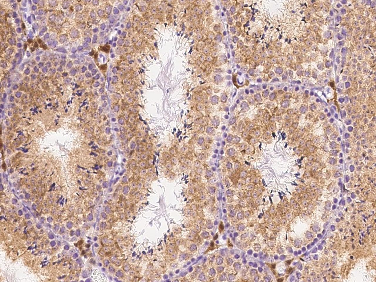 SFRP1 Antibody