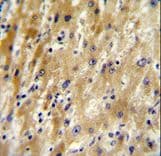 HABP2 Antibody (aa378-408)