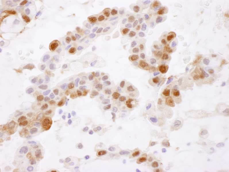 GSTP1 / GST Pi Antibody (aa160-210)