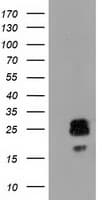 CLPP Antibody (clone OTI1C7)