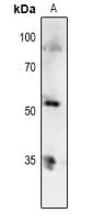 TP53 / p53 Antibody (phospho-Thr81)