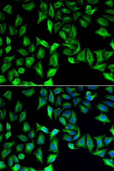 GDA / Nedasin Antibody