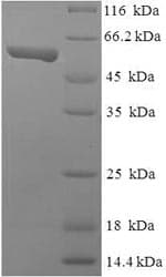 Human TEAD4 Protein (Recombinant 6His-SUMO, N-terminus)