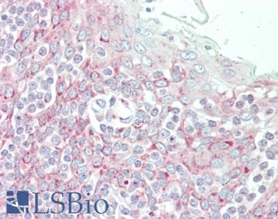 IHC-plus™ LTBR Antibody (N-Terminus)