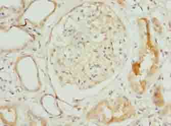 NOP10 Antibody