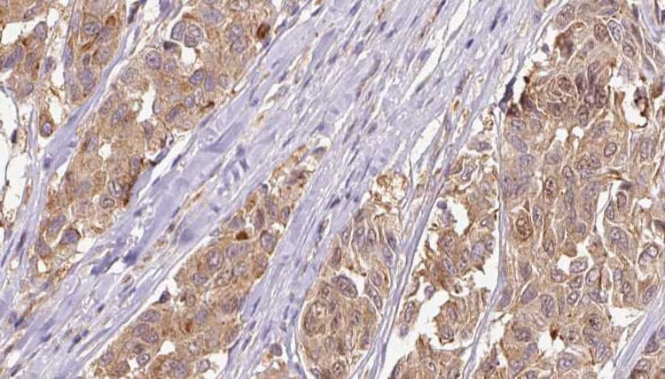 NMU / Neuromedin U Antibody