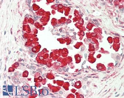 IHC-plus™ UBE2Q2 Antibody (aa1-375)
