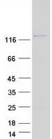 Human DGKD Protein (Recombinant Myc-DDK (Flag))