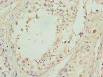 CALCOCO1 / CoCoa Antibody