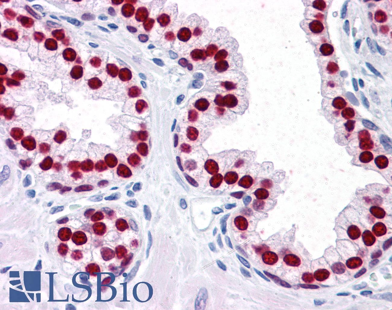 IHC-plus™ FOXA1 Antibody (clone 4F6)