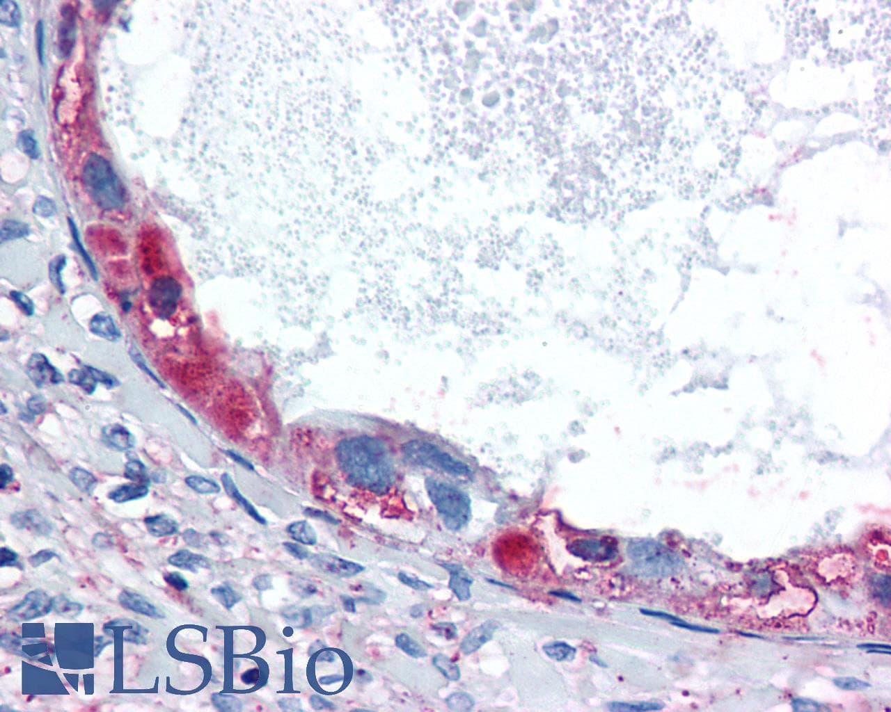 PathPlus™ GPRC5A / RAI3 Antibody (Transmembrane Domain)