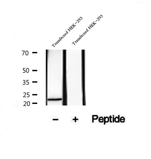 Polyclonal Rabbit anti-Human HBXIP Antibody (IHC, WB)