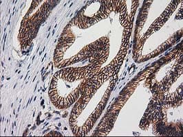 CTNNB1 / Beta Catenin Antibody (clone OTI6A3)