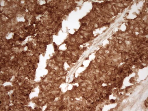 Monoclonal Mouse anti-Human PRMT5 Antibody (clone OTI4G7, aa238-499, IHC)