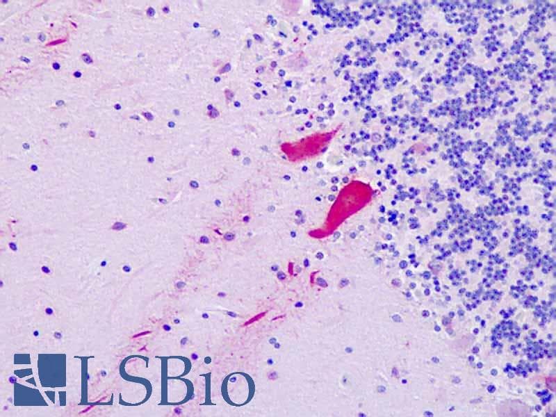 IHC-plus™ NR1I3 / CAR Antibody (aa71-120)