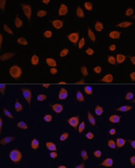 ZCCHC3 Antibody