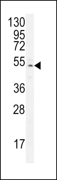 ZNF829 Antibody (aa127-155)
