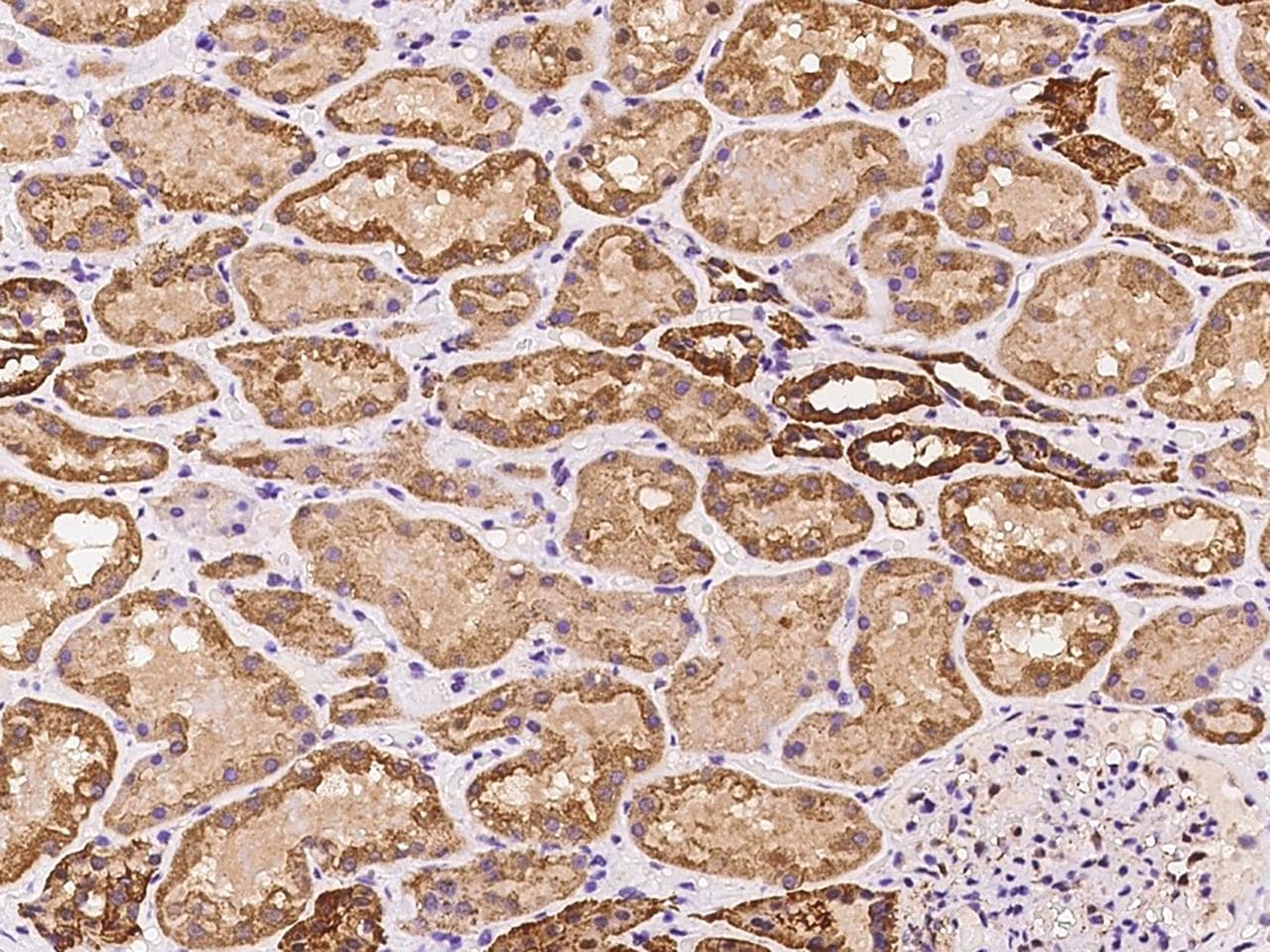 ARA70 / NCOA4 Antibody