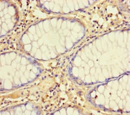 Polyclonal Rabbit anti-Human MRPL21 Antibody