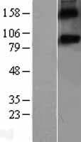 Human SPON1 / F-Spondin Protein (Over-Expression Lysate Myc-DDK (Flag))