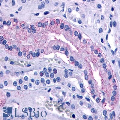 Polyclonal Rabbit anti-Human AVPR2 / V2R Antibody (Cytoplasmic Domain, IHC)