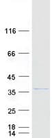 Human C5orf35 Protein (Recombinant Myc-DDK (Flag))