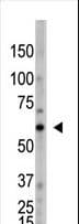 OASL Antibody (aa484-514)