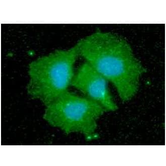 Monoclonal Mouse anti-Human CPOX Antibody (clone AT36B10, WB)