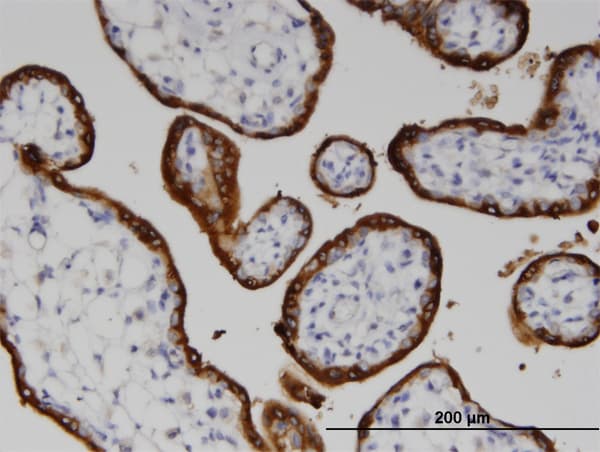 Monoclonal Mouse anti-Human LSS Antibody (clone 2E4, IHC)